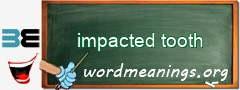 WordMeaning blackboard for impacted tooth